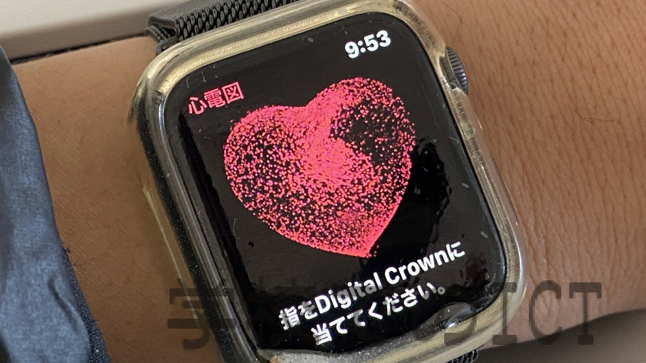 Apple Watchで心電図